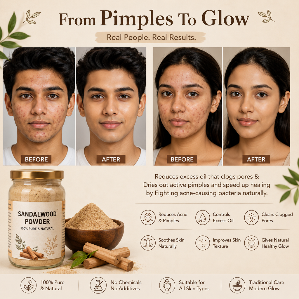 ✨Calm, Refresh & Nourish Your Skin with 100% Pure Sandalwood Powder🌸